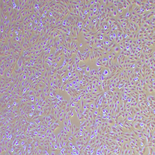 GES-1人胃黏膜上皮细胞（STR鉴定正确）