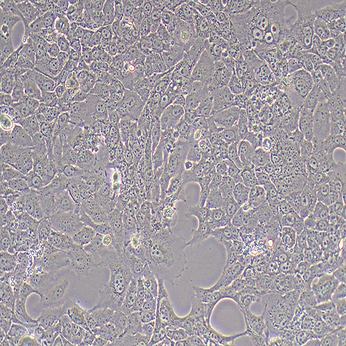 HCC827人非小细胞肺癌细胞（STR鉴定正确）