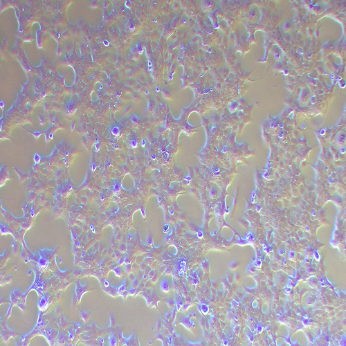 HCC827人非小细胞肺癌细胞（STR鉴定正确）