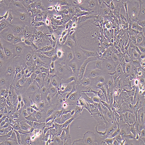 HCCC-9810人胆管细胞型肝癌细胞（STR鉴定正确）