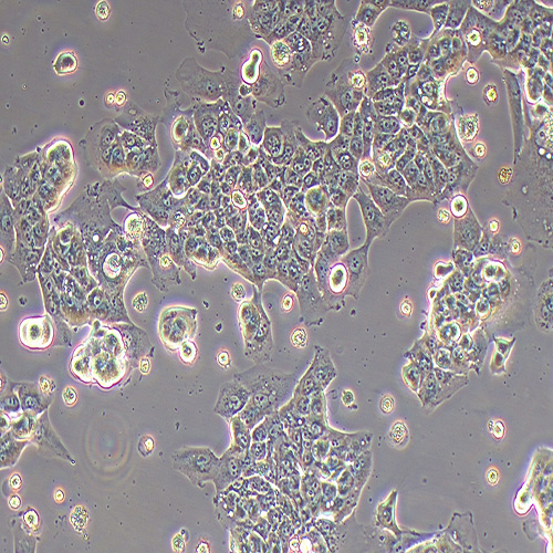 HCC-LM3人高转移肝癌细胞（STR鉴定正确）