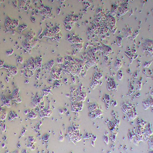 HCC-LM3人高转移肝癌细胞（STR鉴定正确）
