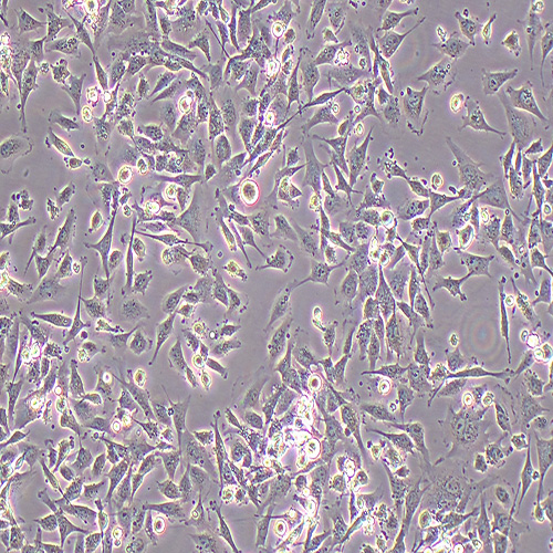 HCMEC/D3人脑微血管内皮细胞（永生化）（STR鉴定正确）