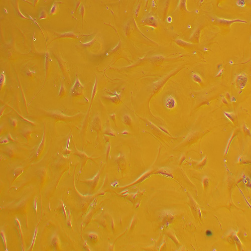HDPSC人牙髓干细胞