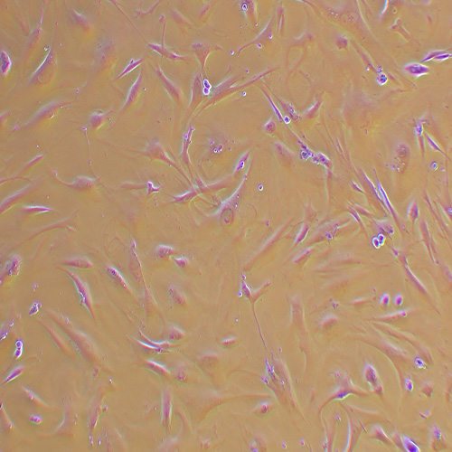 HDPSC人牙髓干细胞
