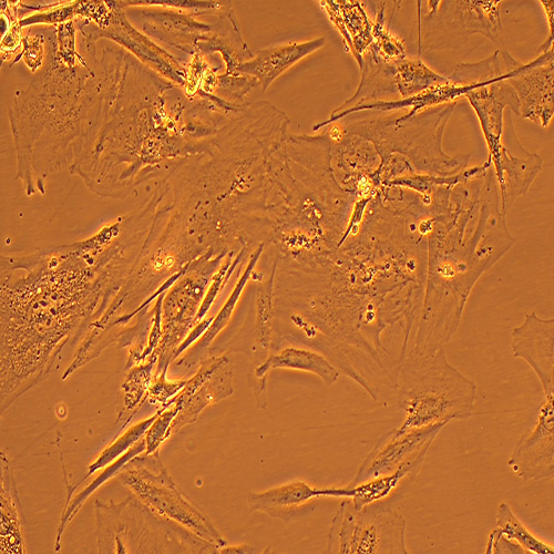 hEM15A人永生化子宫内膜异位症患者在位内膜间质细胞（STR鉴定正确）