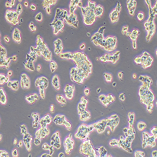 Hep G2人肝癌细胞（STR鉴定正确）