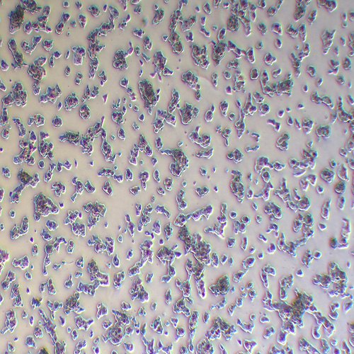 Hep G2人肝癌细胞（STR鉴定正确）