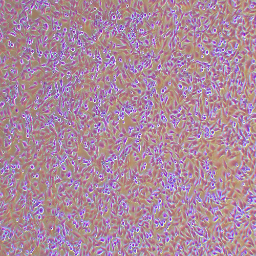 HEY人卵巢癌细胞