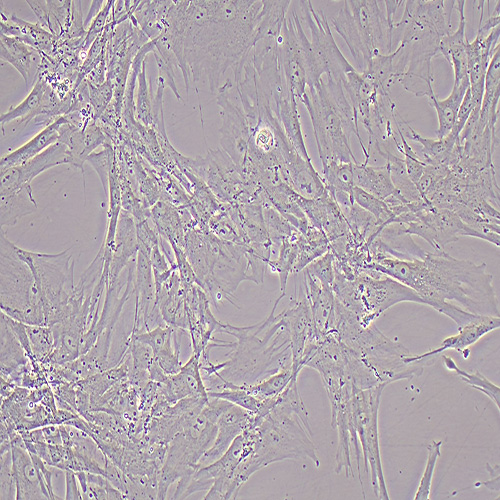 HFL-1人胚肺成纤维细胞（STR鉴定正