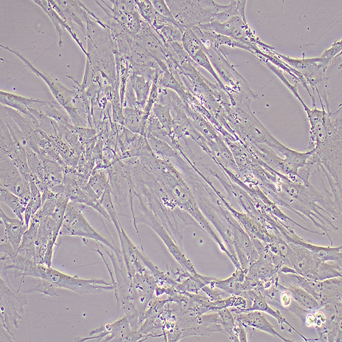 HFL-1人胚肺成纤维细胞（STR鉴定正