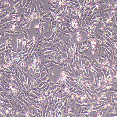 HGC-27人胃癌细胞（STR鉴定正确）
