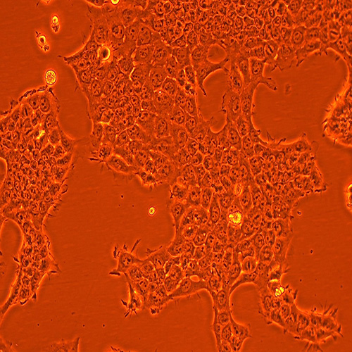 HNE-2人鼻咽癌细胞株（STR鉴定正确）