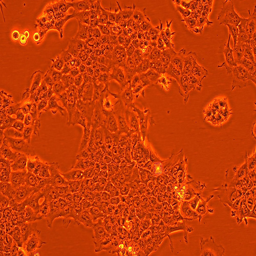 HNE-2人鼻咽癌细胞株（STR鉴定正确）