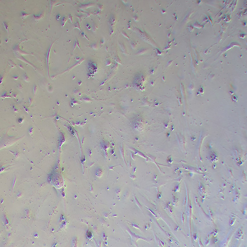 HRCEC人视网膜微血管内皮细胞