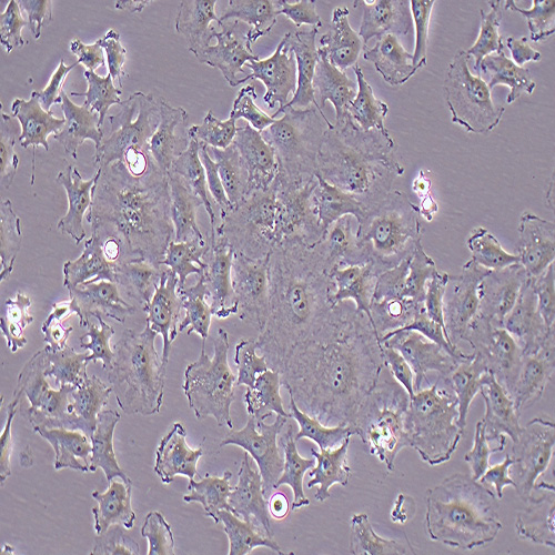 HS578T人乳腺癌细胞