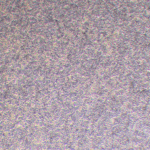 HT-29人结肠癌细胞（STR鉴定正确）