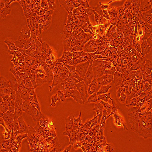 HT-1376人膀胱癌细胞（STR鉴定正确）