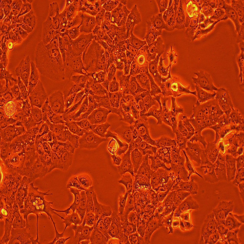 HT-1376人膀胱癌细胞（STR鉴定正确）
