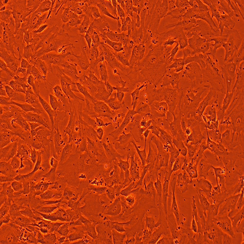 hTERT-HPNE人胰腺导管上皮细胞（STR鉴定正确）