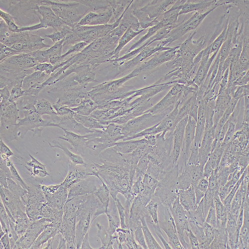 HTMC人眼小梁网细胞（STR鉴定正确）