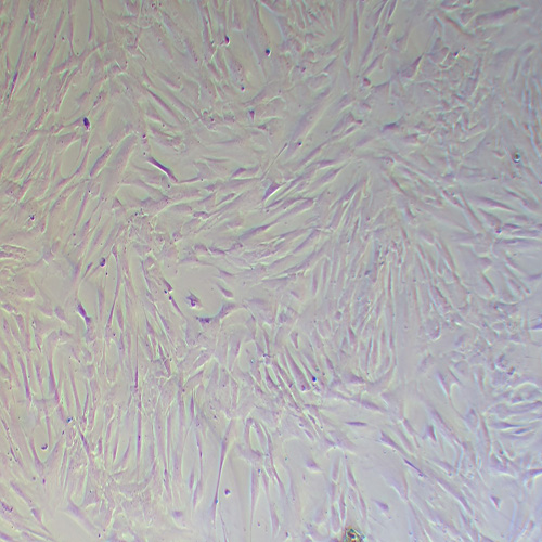 HTMC人眼小梁网细胞（STR鉴定正确）