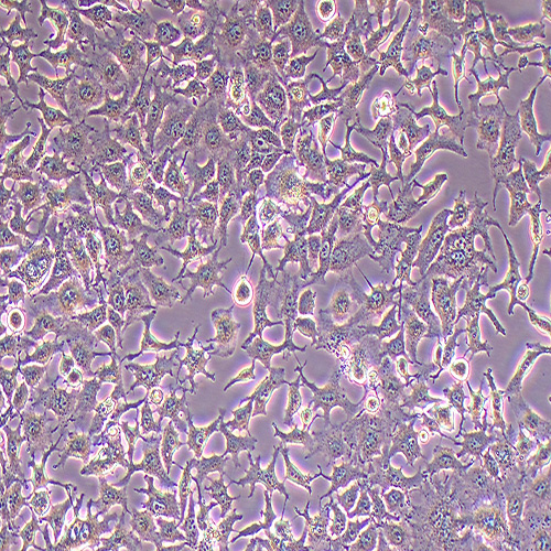 HuH-7人肝癌细胞（STR鉴定正确）