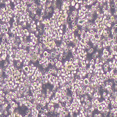 Hut-78人T淋巴细胞白血病细胞