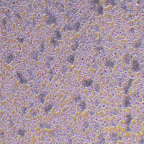 Hut-78人T淋巴细胞白血病细胞