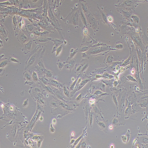 iehESCs人子宫内膜间质细胞(永生化)