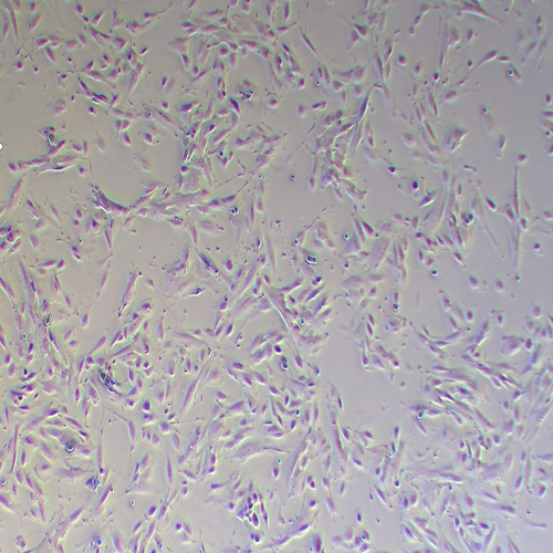 iehESCs人子宫内膜间质细胞(永生化)