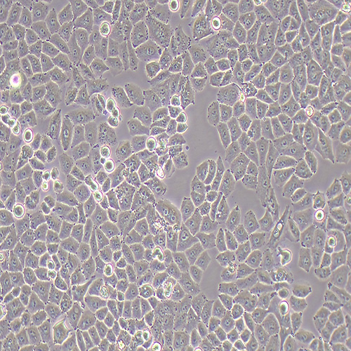 IOSE-80人正常卵巢上皮细胞系（STR鉴定正确）
