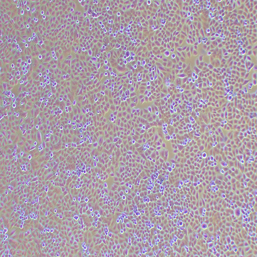 IOSE-80人正常卵巢上皮细胞系（STR鉴定正确）