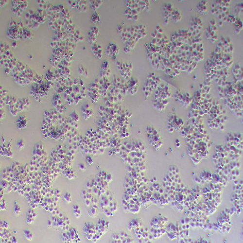 JAR人胎盘绒毛癌细胞