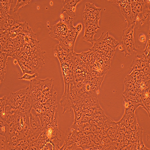 JEG-3人绒毛膜癌细胞（STR鉴定正确）