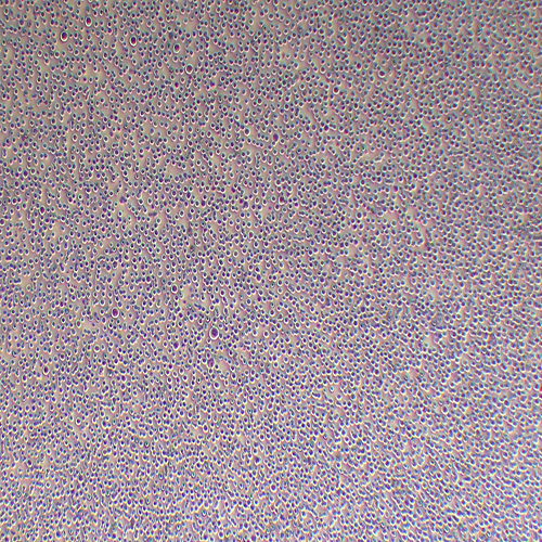 K562人慢性骨髓性白血病细胞系（STR鉴定正确）
