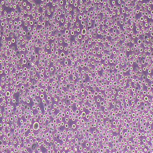 K562人慢性骨髓性白血病细胞系（STR鉴定正确）