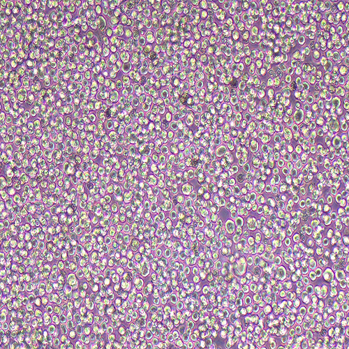 Kasumi-1人急性原粒细胞白血病细胞