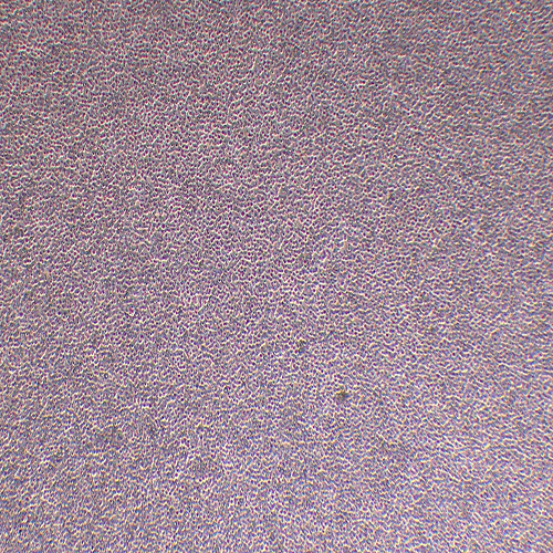 KG-1A人急性髓系细胞白血病细胞