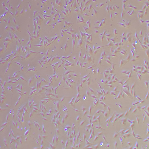 KGN人卵巢颗粒细胞（STR鉴定正确）