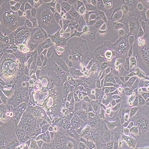 KLE人子宫内膜癌细胞（STR鉴定正确）