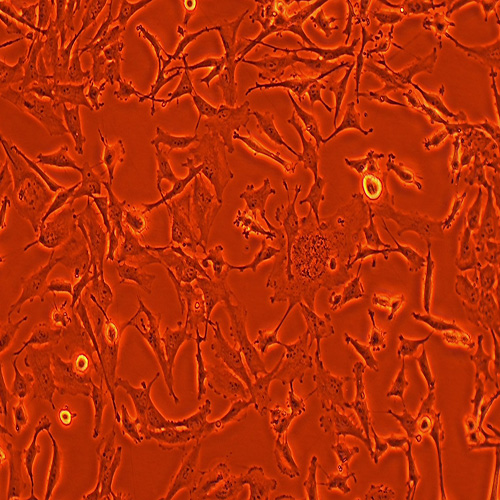 KNS-89人脑胶质瘤细胞（STR鉴定正确）