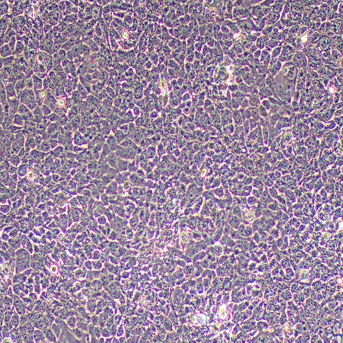 KYSE150人食管鳞癌细胞