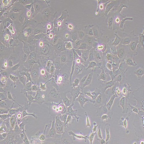 KYSE-410 人食管鳞癌细胞（STR鉴定正确）