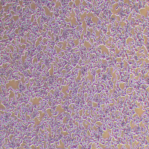 LNCaP人前列腺癌细胞（STR鉴定正确）