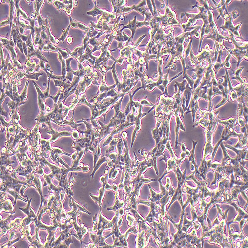LNCaP人前列腺癌细胞（STR鉴定正确）