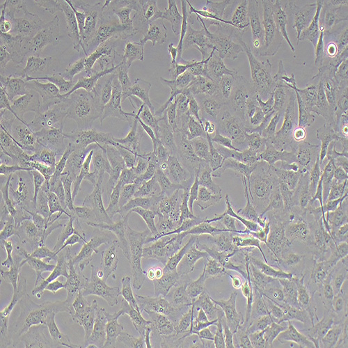 LX-2人肝星形细胞（STR鉴定正确）