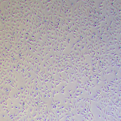 LX-2人肝星形细胞（STR鉴定正确）