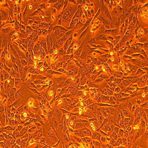 MDA-MB-231人乳腺癌细胞（STR鉴定正确）