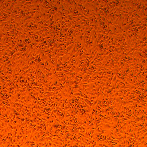 MDA-MB-231人乳腺癌细胞（STR鉴定正确）